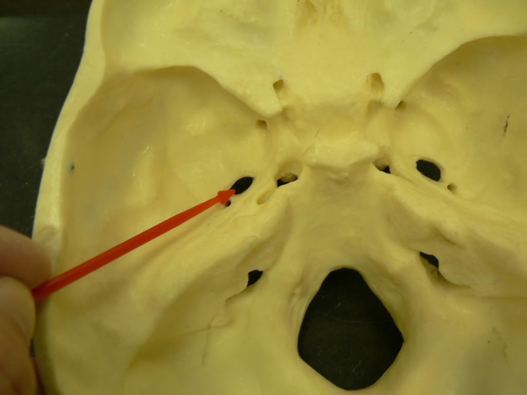 Foramen Ovale Of Sphenoid Bone Photo By Krystal C Photobucket My Xxx Hot Girl 4801